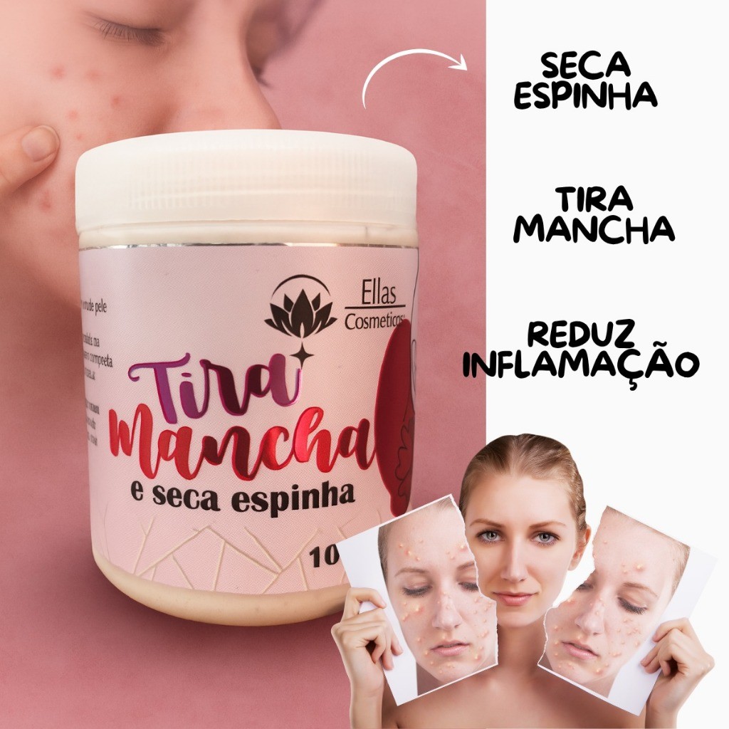 Creme Secativo De Espinhas e Tira Manchas 2 Em 1 Facial seca espinha ...