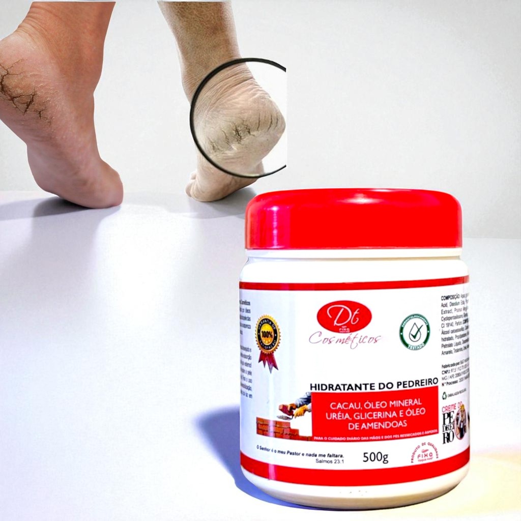 Creme para Rachaduras Pés Ressecados de Pedreiro 500g Ureia Glicerina ...