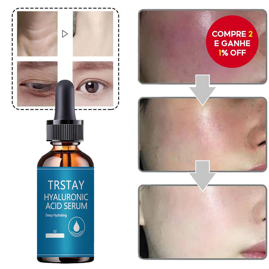 Sérum Facial TRSTAY Vitamina C Líquido Antienvelhecimento Clareador ...