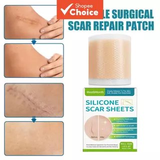 Rolo Médico de Fita para Cicatriz de Silicone Cirurgia