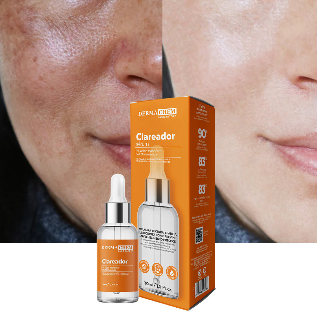 Sérum Clareador Dermachem de Melasma Uniformiza o tom da Pele Clareia ...