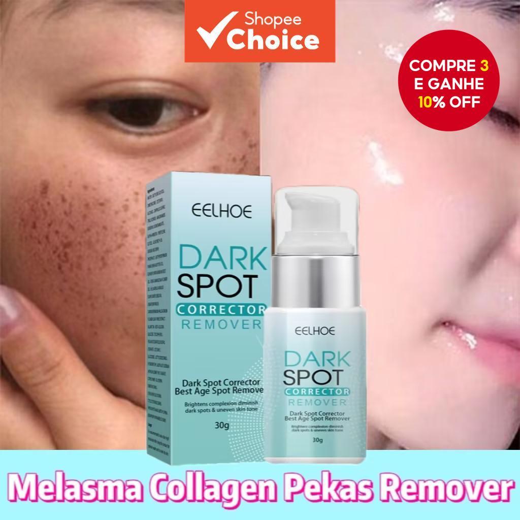 Creme Avançado Removedor de Manchas Escuras e Clareador - Corrige ...