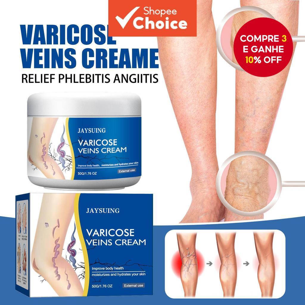 Creme para Varizes nas Pernas 50g, Creme Suavizante e Hidratante, Ajuda ...
