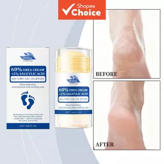 Creme Hidratante Profundo para Pés 30 g com Ureia & Ácido Salicílico – Para Pés Muito Secos, Rachados & Conforto em Oferta na Shopee