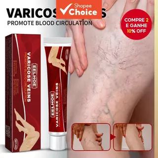 Creme Removedor de Varizes Eelhoe - Eficaz para Cuidados com as Veias das Pernas, Original Earthworm 【Escolha】 em Oferta na Shopee