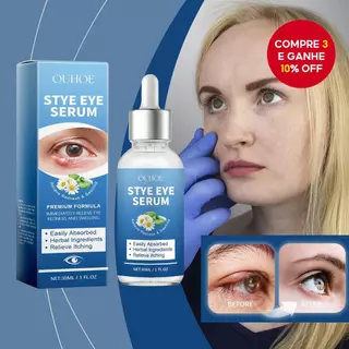 Gotas de Terapia para Olhos Secos Hidratantes 30ml Gotas Lubrificantes Calmantes Instantâneas para Cuidados Diários em Oferta na Shopee