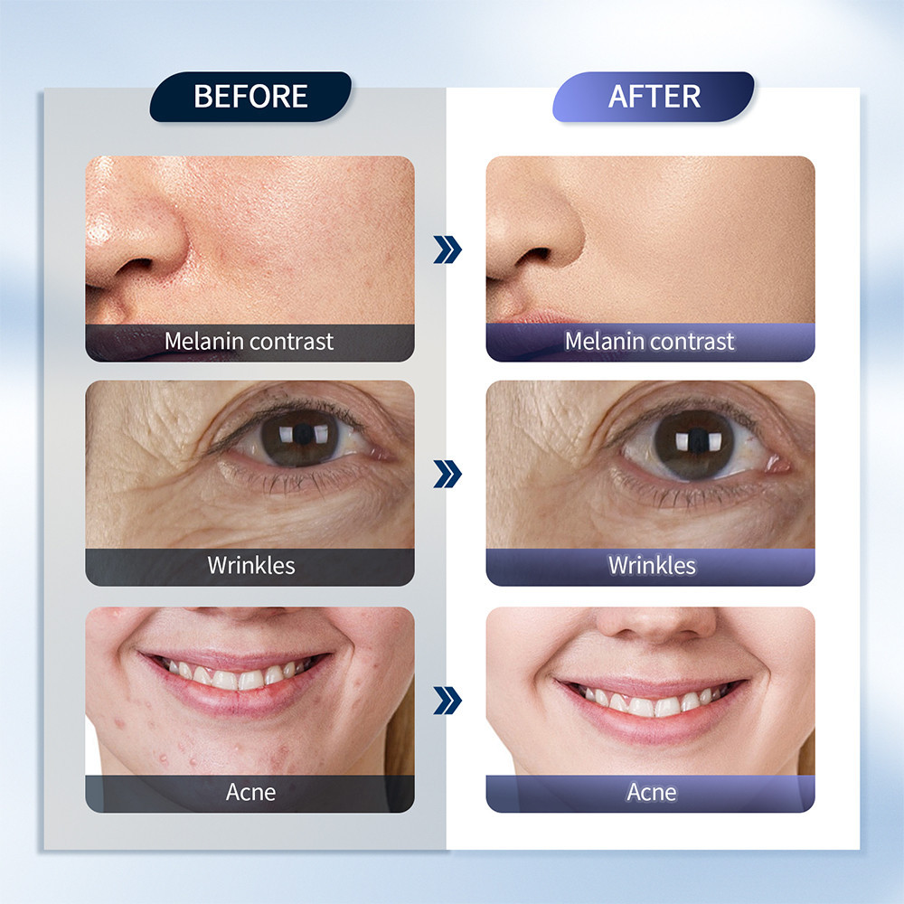 Liarty Experience Professional Grade Skin Care Com Máquina Liarty Experience Professional Grade Skin Care Com Máquina