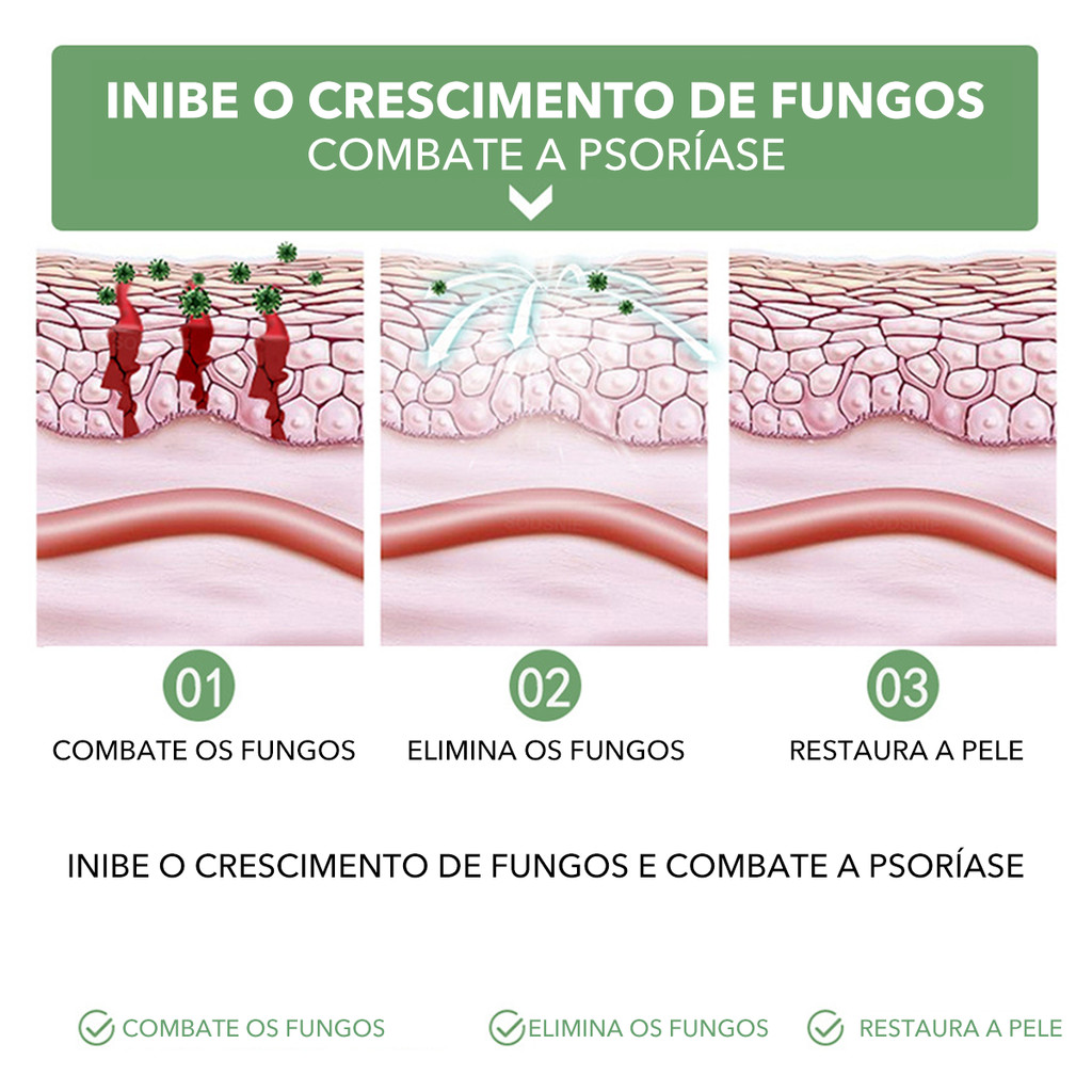 Creme Para A Pele , Antibacteriano Eczema Nu , Pomada Dermatite ...