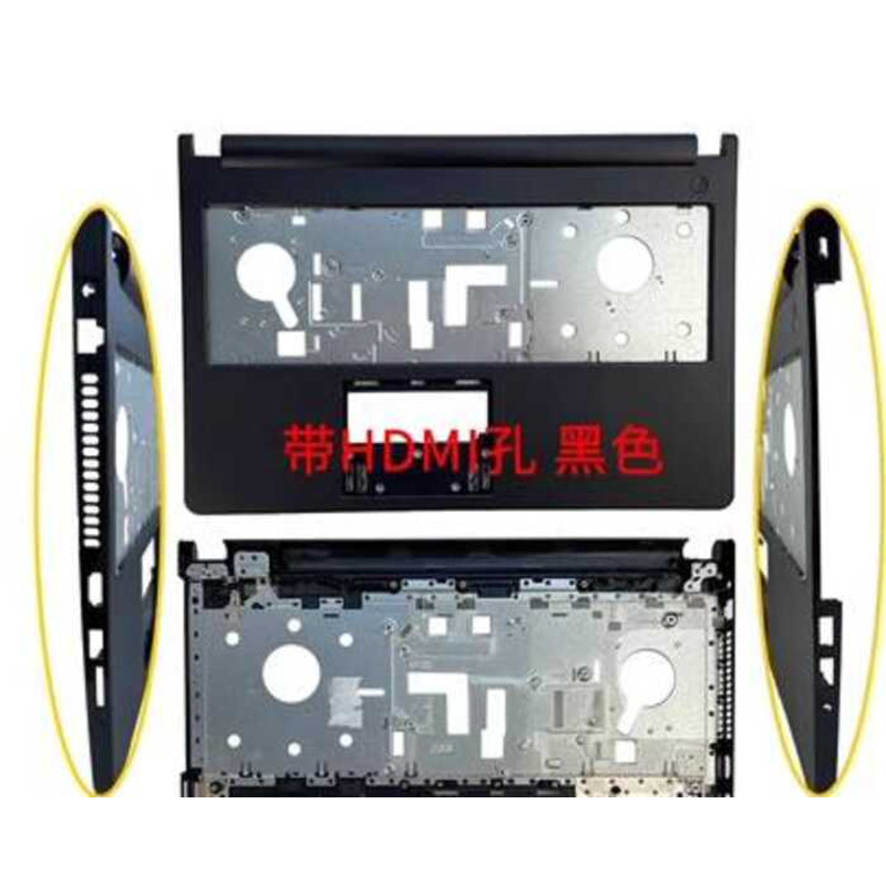 DELL DELL 15U-5000 5555 5558 5559 V3558 V3559 Eixo de tela Um escudo ...