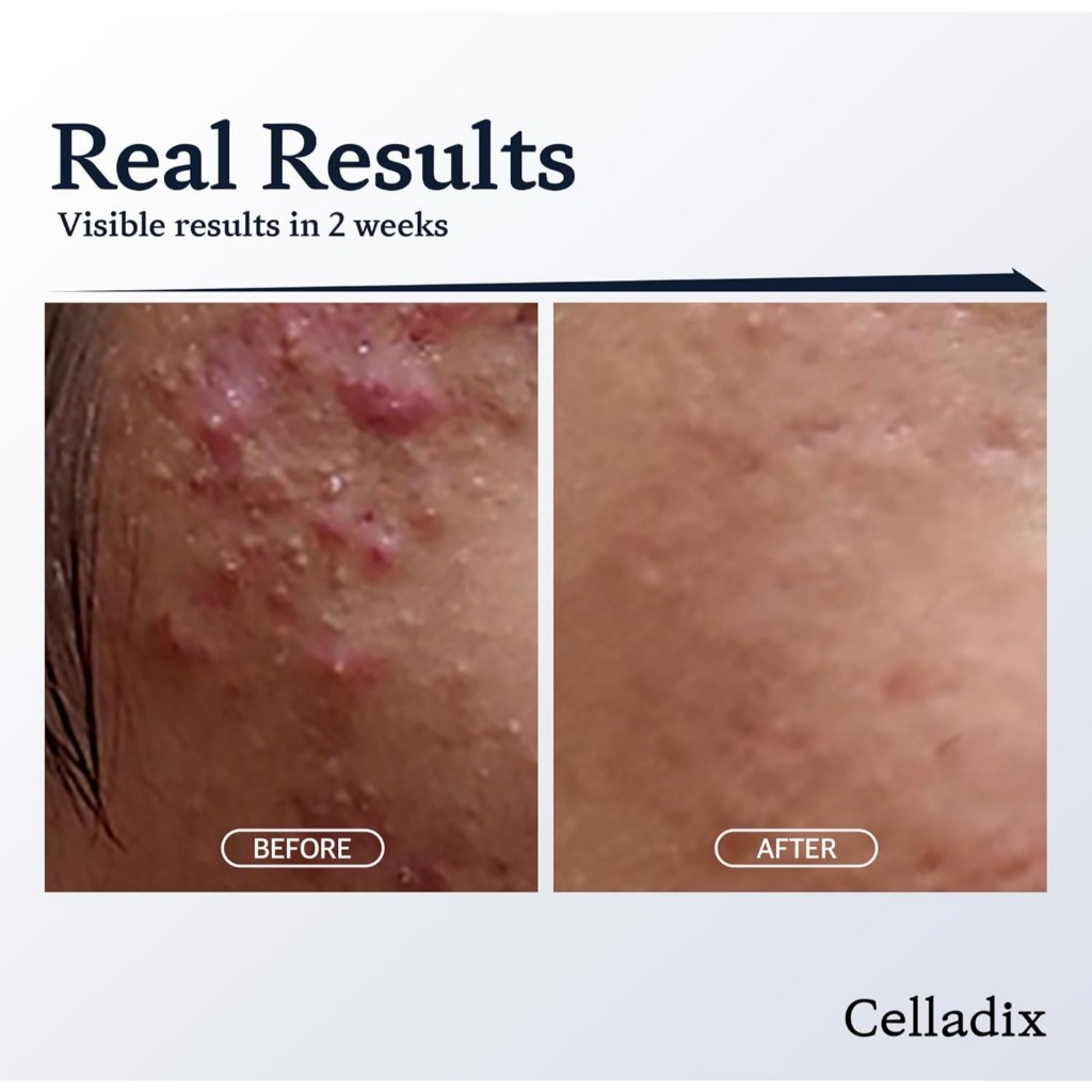 Celladix Sebum Rebalancing Rx 131 Ampoule, 20mL | Minimize