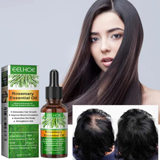 Óleo Capilar Com Infusão De Alecrim Óleos De Vitamina E , Coco Raiz De Gengibre-30ml Para Controle De Frizz , Brilho Nut