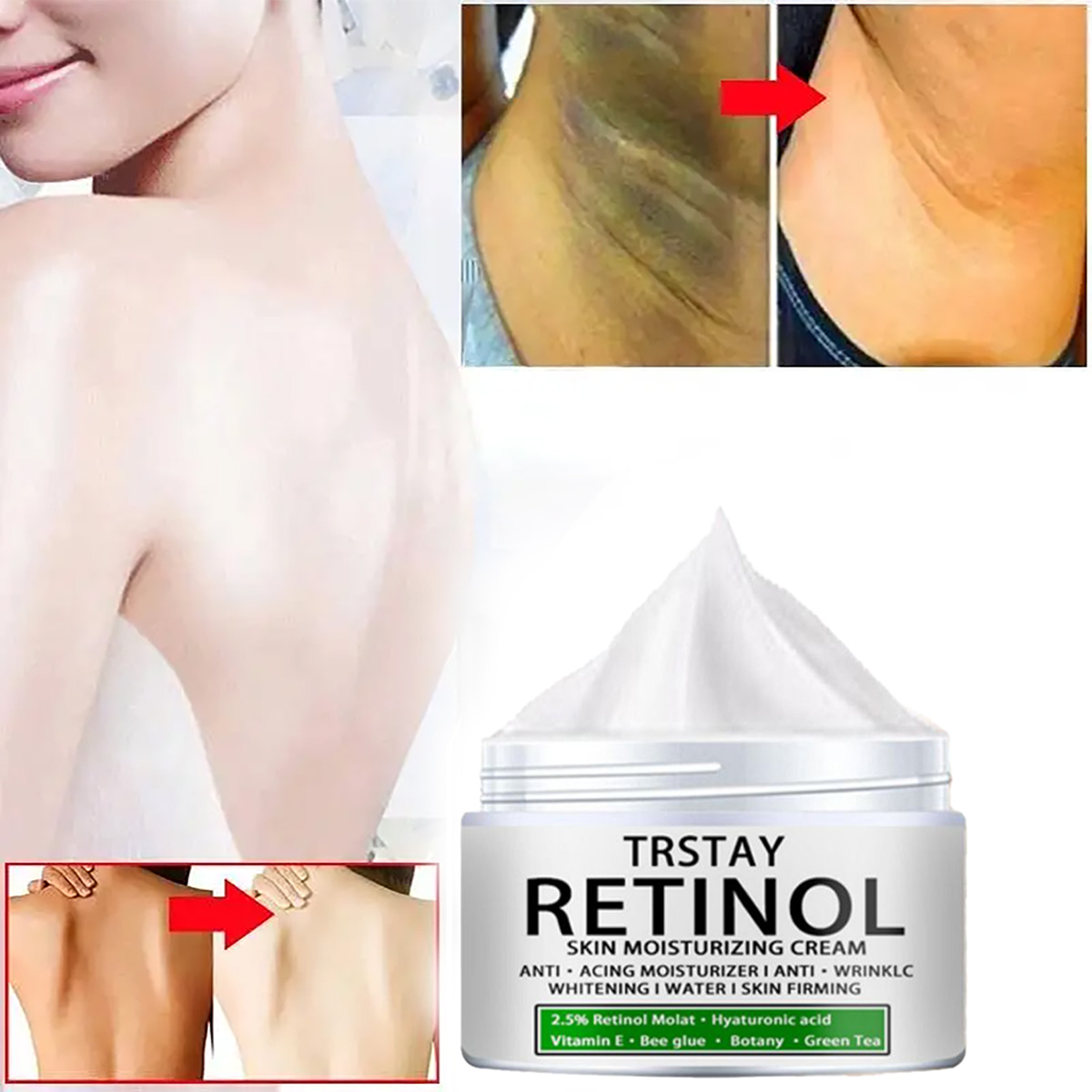 Creme Clareador Corporal Eelhoe , Hidratante Para Corpo , Axilas ...