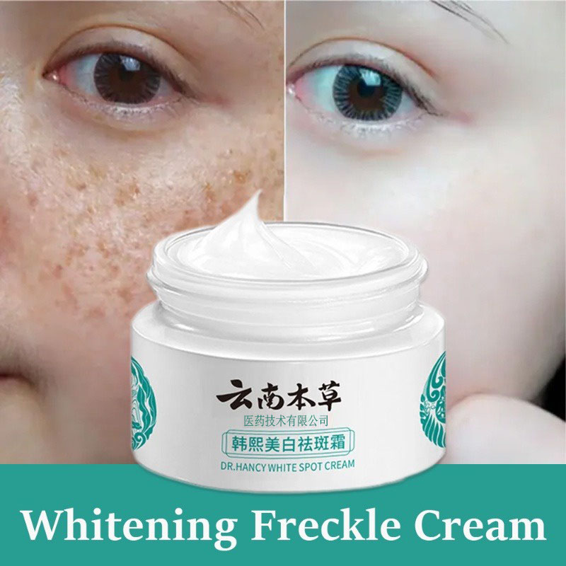 Creme Japonês Yunnan Ervas para Melasma, Sarda e Pontos de Idade com Alta Hidratação e Removedor de Cloasma