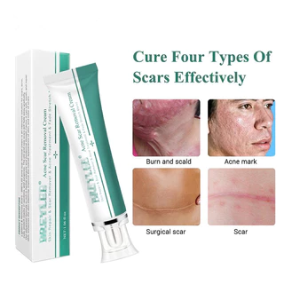 BREYLEE Acne Cicatriz Remoção Creme Reparação Da Pele Cuidados Com A Tratamento Remover Estrias