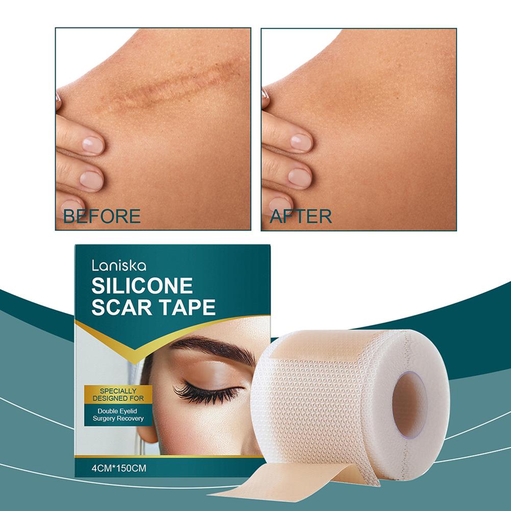 Folhas de Silicone para Cicatrizes, Fita de Silicone para Cicatrizes ...