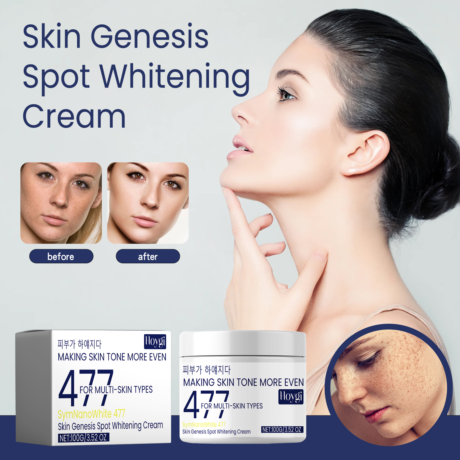 477 Creme Coreano para Hidratar a Pele Seca, Hidratante Anti-Rugas para ...